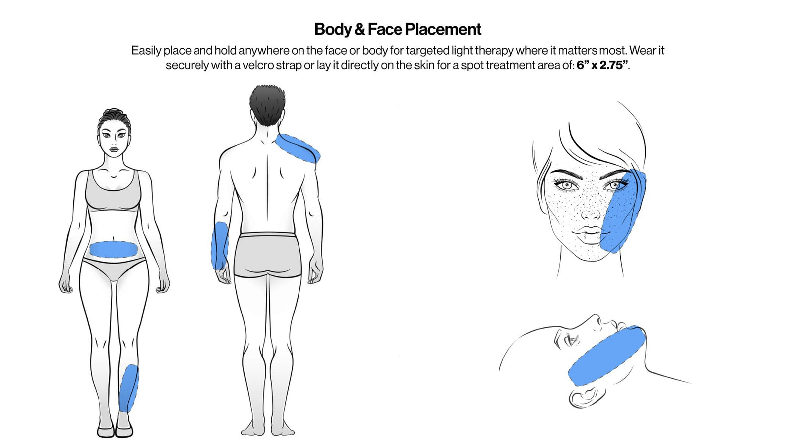 Ideal Targeted Spot Treatments